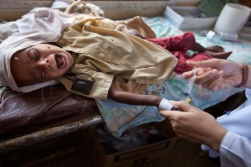 "يونيسيف": الالتهاب الرئوي والإسهال يقتلان 1.4 مليون طفل سنوياً