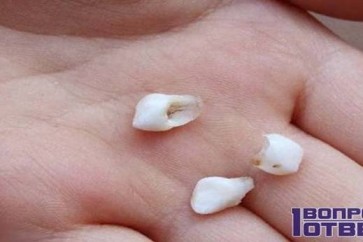 العلماء: يفضل الاحتفاظ بأسنان الأطفال اللبنية بعد سقوطها