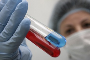 تطوير جهاز يحدد فصيلة الدم خلال 30 ثانية فقط، دون الحاجة إلى إهدار الكثير