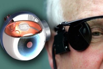 ابتكرها علماء بريطانيون من مواد ليّنة لأول مرة في العالم… شبكية صناعية للعين