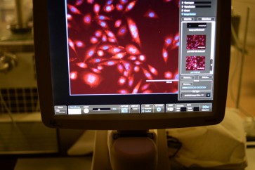 بعد 20 عاما من البحث...علماء ينجحون في تربية خلايا جذعية مكونة للدم