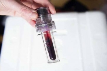 العلماء الروس يولدون الكهرباء من دم الإنسان
