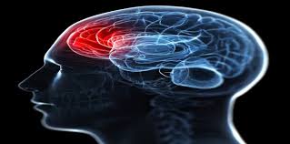 احذر.. ارتفاع مستويات الحديد فى الدم يزيد خطر الإصابة بالسكتة الدماغية